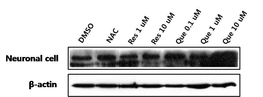 Western blot 분석을 통한 신경 세포 에서의 ER stress sensor 역할을 수행하는 ATF6α 단백질의 발현수준 확인.