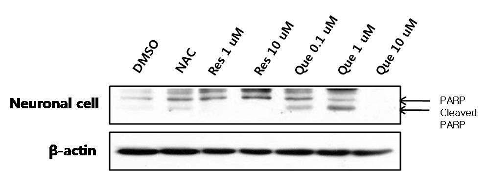 Western blot 분석을 통한 신경 세포 에서의 세포사멸 단계의 특징적인 징표인 PARP 단백질의 발 현수준 및 항산화 효과 확인.