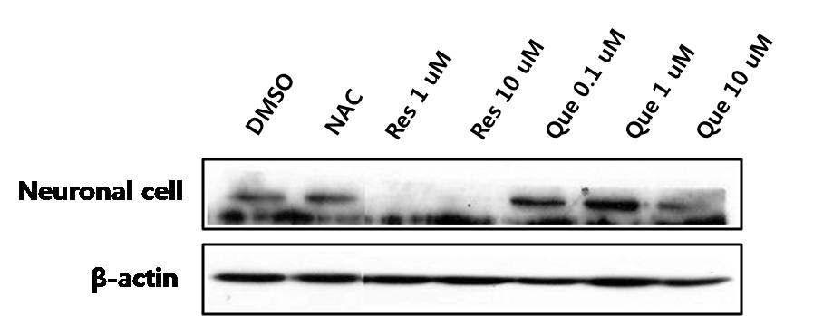 Western blot 분석을 통한 신경 세포 에서의 ER stress의 marker 및 unfolded 단백질에서 folded 단백질로의 전환을 일으키는 Grp-78/Bip 단백질의 발현수준 확인.