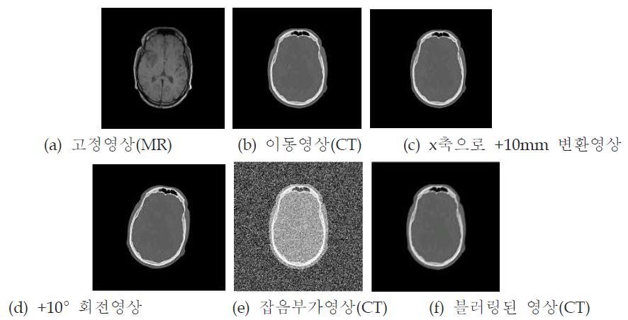 다중 모달리티 실험결과에 사용된 변환된 MR과 CT영상