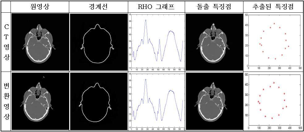 CT의 원영상과 이동과 회전된 영상의 특징점 추출과정