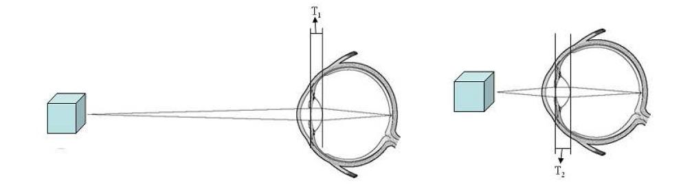 원거리와 근거리의 물체를 볼 때 눈 수정체의 두께(T1과 T2) 변화