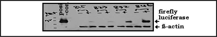 Selection and confirmation of Psi-firefly luciferase stable cell lines