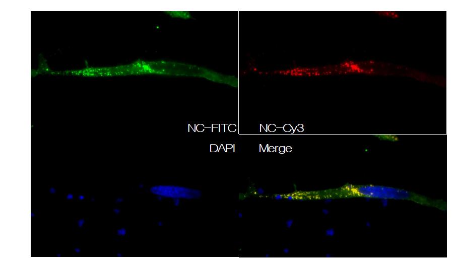 localization of HIV-Gag protein