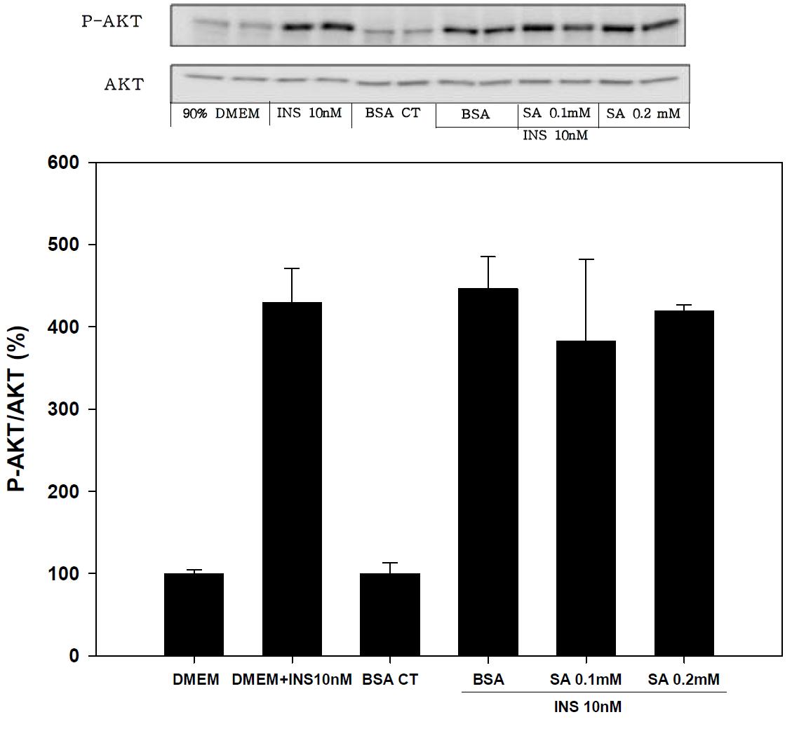 Expression of P-AKT/AKT on 24hr stearic acid treated in SK-hep-1 cell