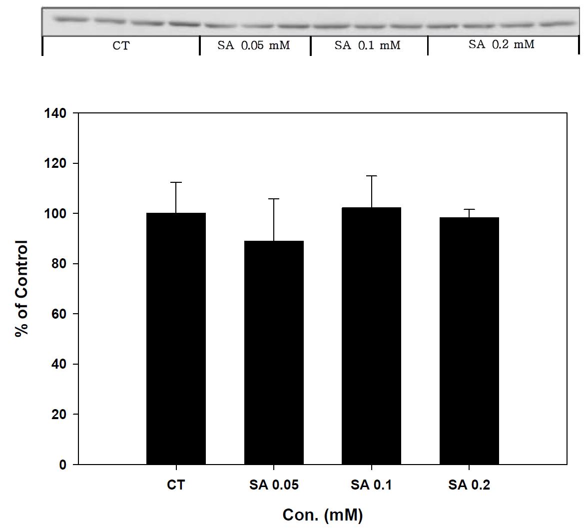 Expression of GR in stearic acid treated SK-hep-1 cell