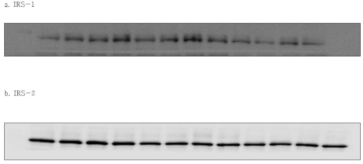 Expression of IRS in SK-hep-1 cell