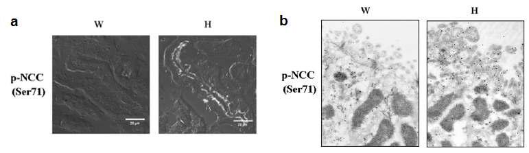 PHAII 돌연변이를 가지는 WNK4 D561A/+ 생쥐 원위세뇨관의 인산화된 NCC의 발현 증가