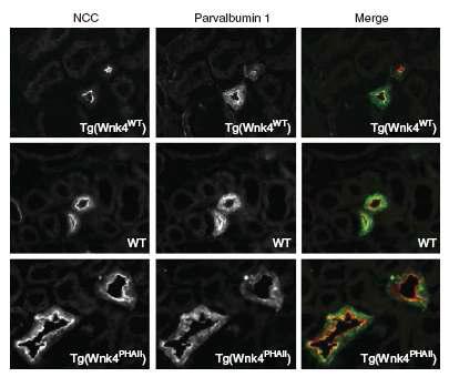 WNK4를 과발현시킨 생쥐와 WNK4의 PHA2 관련 돌연변이를 과발현시킨 쥐의 신장의 DCT세포크기 변화