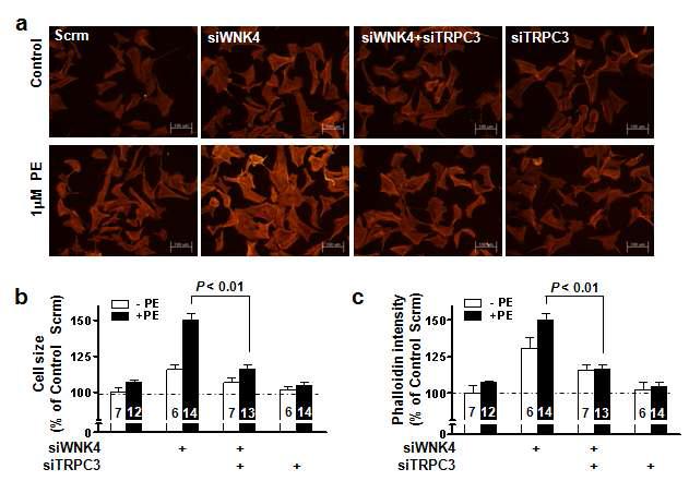 VSMC의 세포비대에 미치는 WNK4와 TRPC3 상호작용의 역할