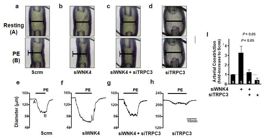 3rd branch mesentary artery의 수축력에 관여하는 WNK4의 TRPC3 활성 조절의 중요성