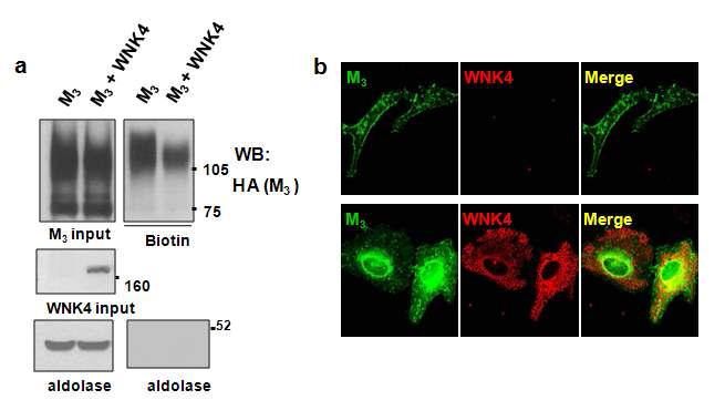 M3R의 세포막발현을 억제하는 WNK4