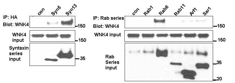 WNK4와 여러 세포막이동과정 관련 단백과의 상호작용.
