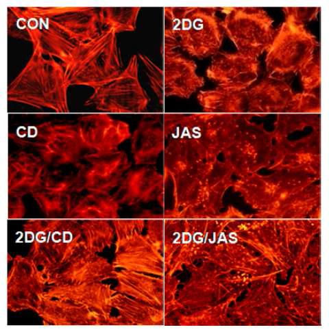 토끼 관절 연골세포의 액틴 세포 골격 구조는 2-deoxy-D-glucose (2DG)에 의해 조절 된다.