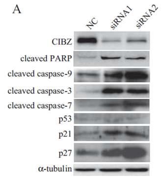 CIBZ 유전자 발현의 억제에 따른 세포사멸 관련 유전자들의 발현 변화.