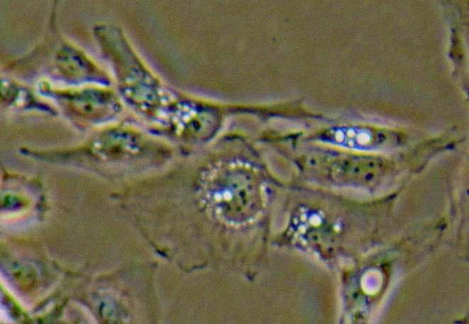 I2 cell 현미경 사진, 세포내에 액포가 많이 보이는 것이 I2 cell의 특징이다.