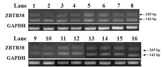 다양한 사람의 조직들에서 ZBTB38 유전자의 프라이머 (ZBF-ZBR)을 이용한 RT-PCR 분석.