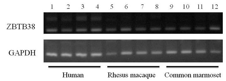 인간과 영장류의 조직들에서 ZBTB38 유전자의 프라이머 (ZBF-ZBR)를 이용한 RT-PCR 분석.