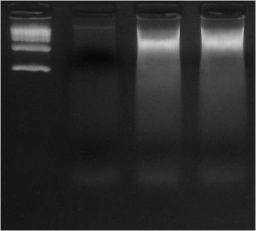 Actinomycin D 처리후 DNA fragmentation test