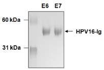 HPV 16형 E6과 E7 fusion Ig 단백질의 생산 및 정제. Limiting dilution method를 이용하 여 가장 많은 재조합 단백질을 생산 할 수 있는 CHO 세포를 cloning하고 대량으로 세포 배양 후, 세포 배양액에 포함되어 있는 재조합 단백질을 protein A column을 이용하여 정 제하였음.