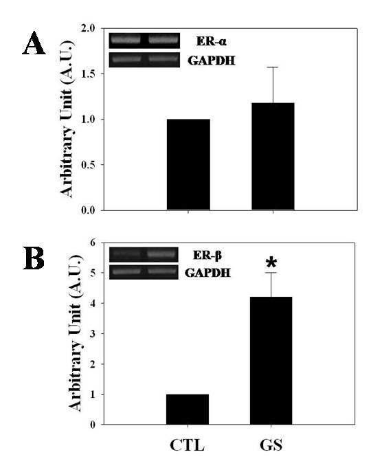 Effects of GS ICV infusion on the expression of ER-α and ER-β in the immature rat hypothalami