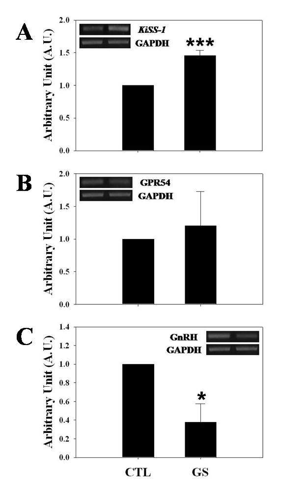 Effects of GS ICV infusion on the expression of KiSS-1, GPR54 and GnRH in the immature rat hypothalami