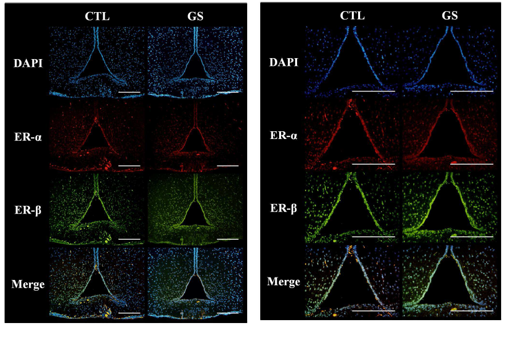 Fluorexcent immunohistochemistry of the ER-α and ER-β in the immature rat hypothalami