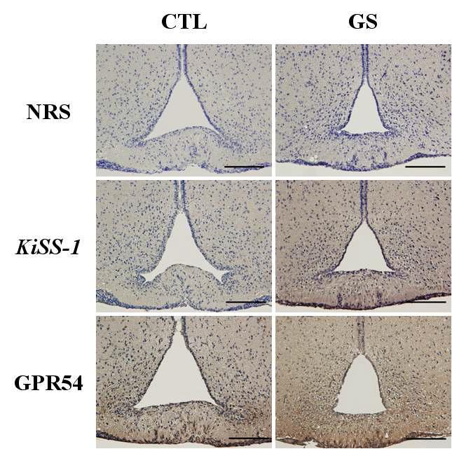 Immunohistochemistry of the KiSS-1 and GPR54 in the immature rat hypothalami