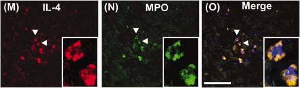 IL-4 producing cells were colocalized with MPO positive neutrophils