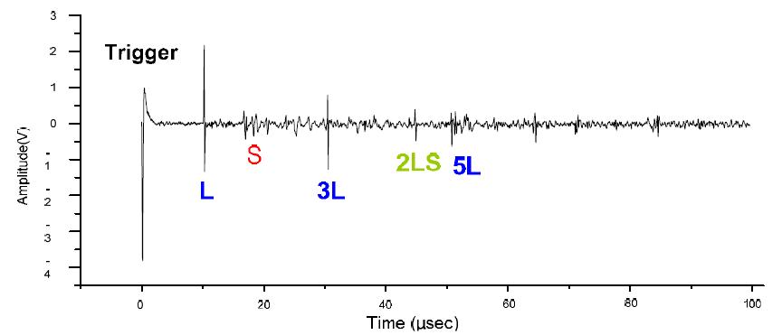 Multiple Reflection of Laser Generated Longitudinal Pulses within 60mm SM45C block