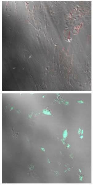 배양한 감각신경절 신경세포에서의 각종 DPR (TRP ion channel)의 발현을 specific polyclonal antibody를 사용한 면역조직화학적 방법으로 조사한 예. (상) mouse polyclonal anti-TRPV1 및 goat polyclonal anti-TRPV3 1차 항체를 동시 처리후 각기 rhodamine (붉은색) 과 HRP (하) conjugated 2차 항체를 이용하여 visualization 시킨 감각신경세포들. TRPV1이 광범위한 감각신경세포에서 발현되며 TRPV3는 제한된 세포에서 (붉은 화살표) 발현됨을 알 수 있음 (200배율). (우) mouse polyclonal anti-TRPV2 1차 항체 처리후 Alexa Fluor 488 conjugated 2차 항체를 이용하여 visualization 시킨 감각신경세포들. 일부 세포에서 발현됨을 알 수 있으며 통각세포 외에도 large-diameter 세포에서도 관찰됨 (200배율).