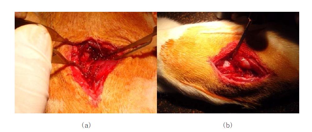 Selective DRG injection of the nano particle with fibrin gel at right L5/6 level.(a) Right L5/6 foramen was exposed.