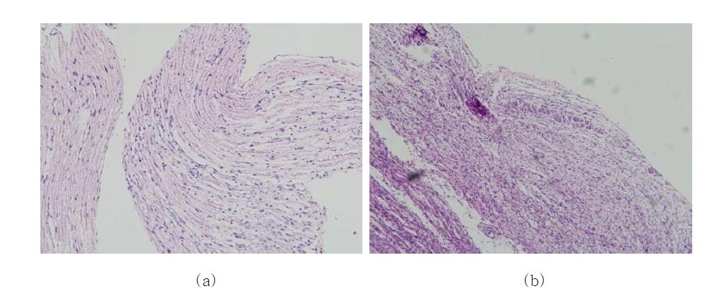 Light microscopic findings of right L5/6 DRG of the Rat 1(a), Rat 8 (b). (x400)