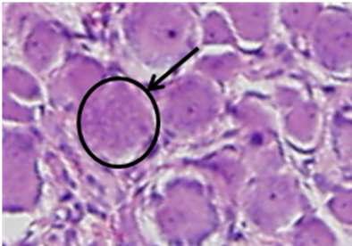 Degenerative neuron in right L5/6 DRG of Rat 9.(x800)