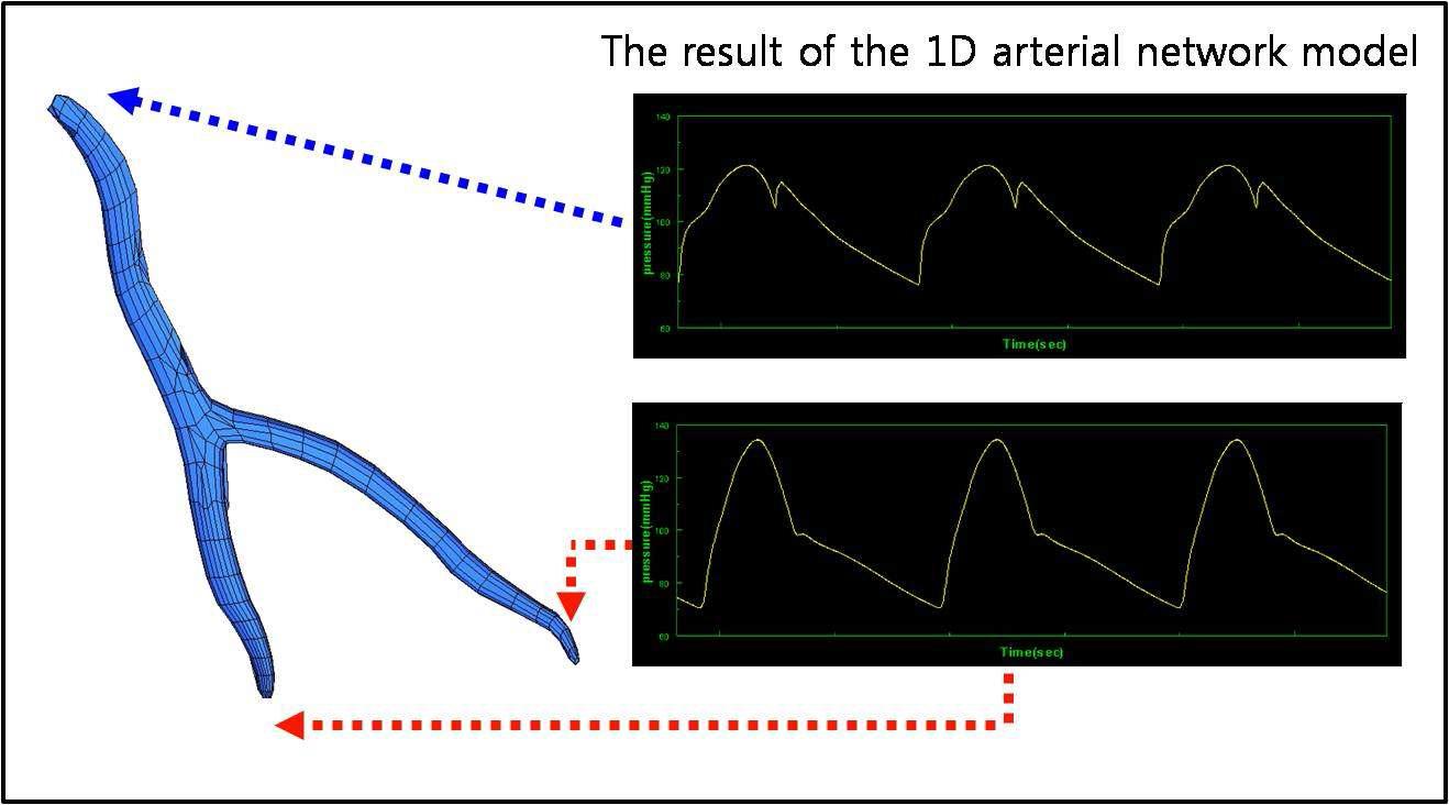 3차원 혈류역학 해석의 경계조건으로 동맥 네트워크 모델에서 얻어진 평균 속도와 평균 압력 적용