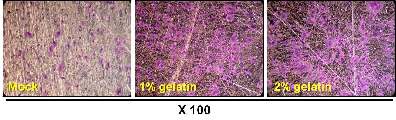 젤라틴의 티타늄표면 흡착에 의한 골아세포 성장(72시간 후)
