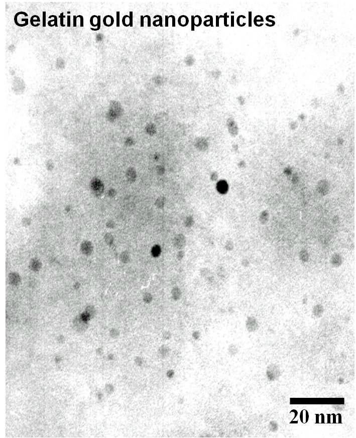 20nm 이하로 제조된 나노골드-젤라틴 입자의 현미경 사진