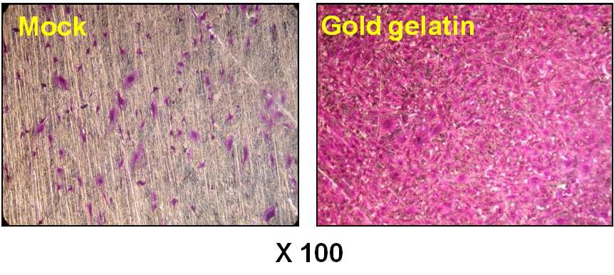 나노골드-젤라틴의 티타늄표면 흡착에 의한 골아세포성장 (72시간 후)