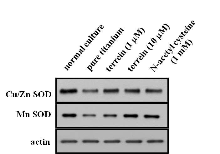 티타늄 표면에서 골아세포의 항산화 분자 발현과 Terrein 처리에 의한 항산화 분자의 발현 증가효과