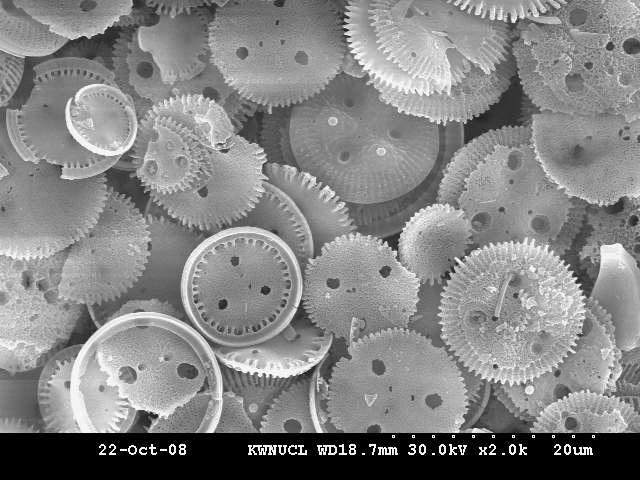 SEM image of cleaned diatoms.