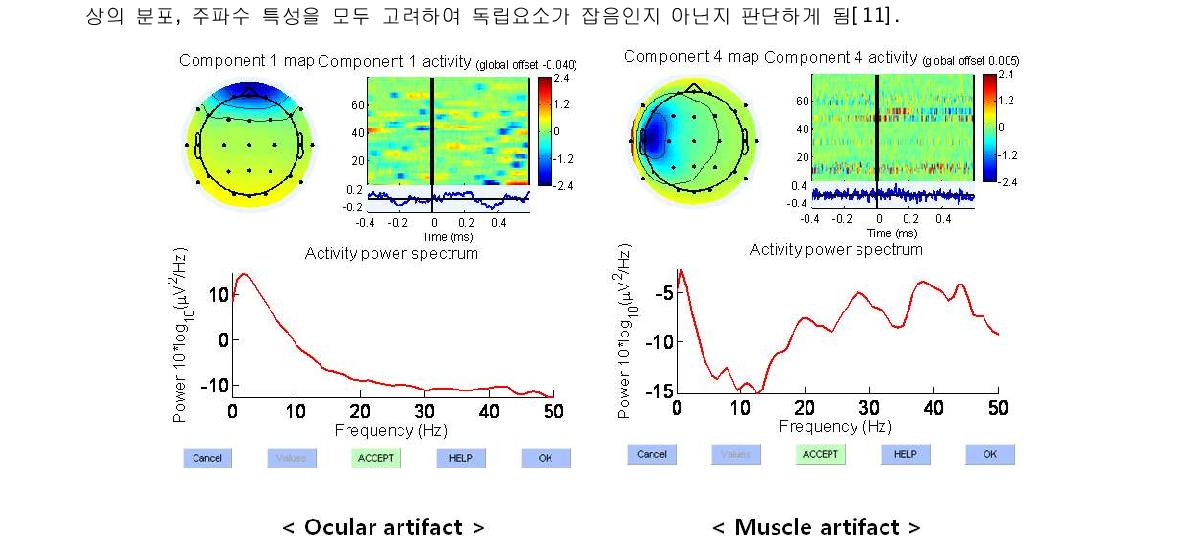 잡음에 해당하는 독립요소들의 예시. 좌: 안구움직임에 의한 잡음. 우: 근육의 움직임에 의한 잡음.-채 널잡 음별 요ER소P들 파을형 제을거 구 후해,보 b면ac k잡 p음ro j성ec분tio이n 과효정과에적 으의로해 제얻거어되진었 새음로을운 확 단인일할 시수행 있 신음호(그들림을5 )평. 균 내어 각 움직임에 의한 잡음 제거효과는 주로 전두엽(frontal lobe)쪽 전극들에서, 근육 움직 안구의 효과는 주로 측두엽(temporal lobe)쪽