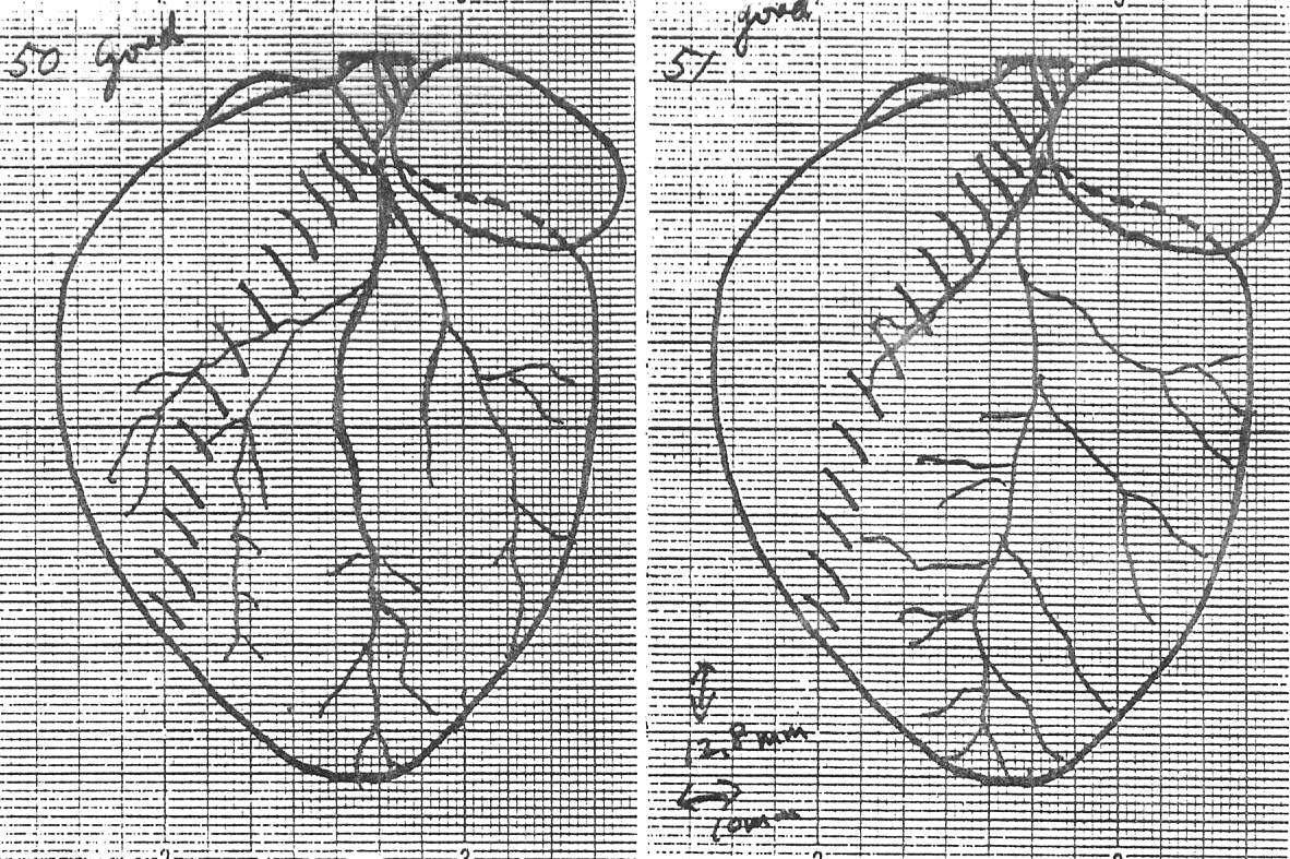 Diagrams of rat left coronary artery