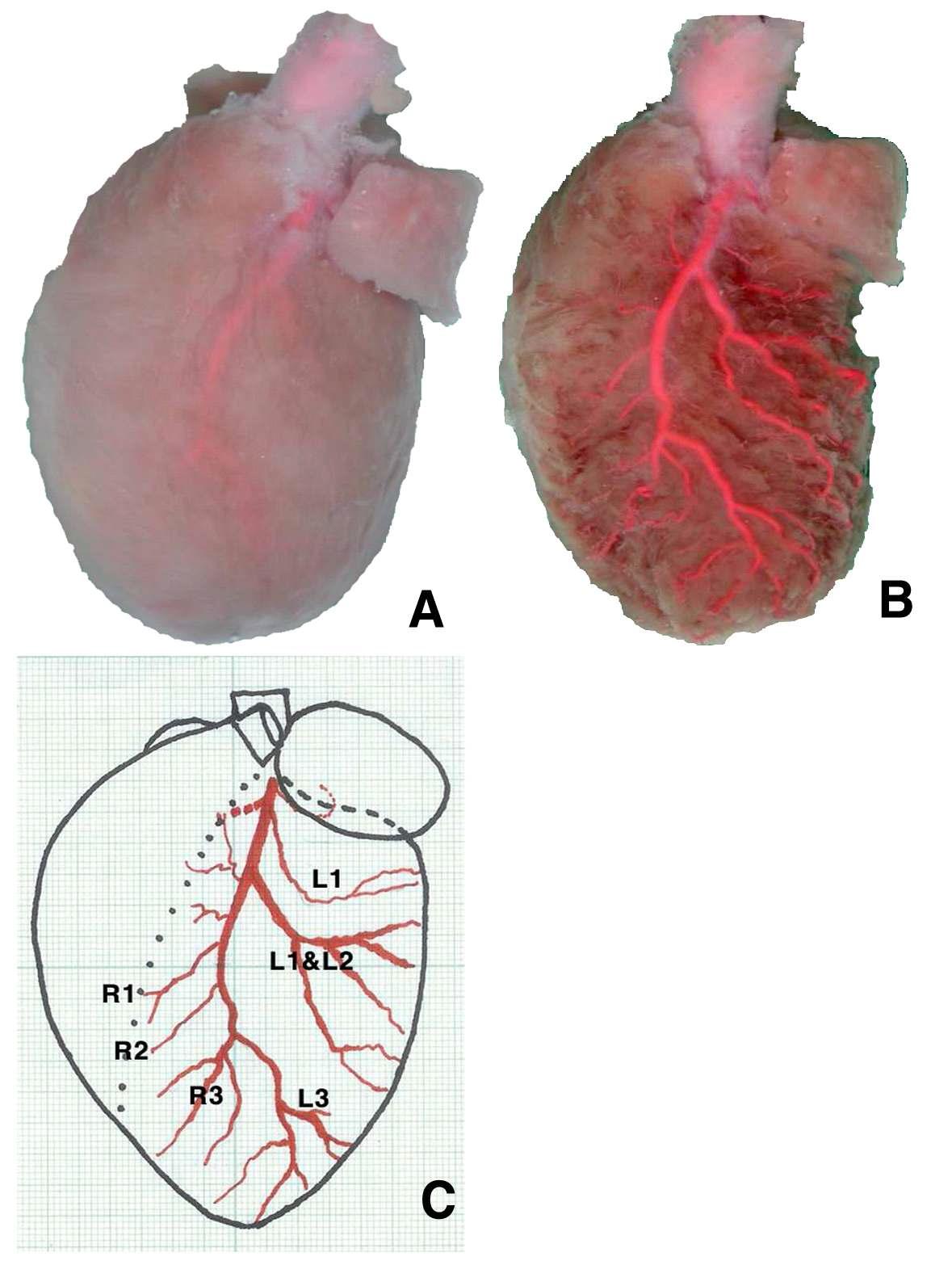 Casting and diagram of left coronary artery in a SD rat.