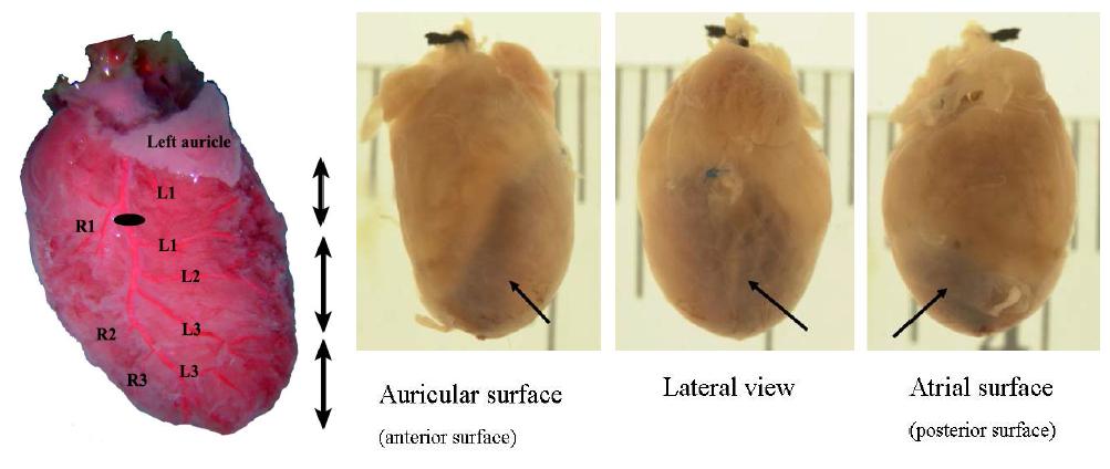 Sample of the infarction of heart at 4 weeks after surgery and the each numbers of ventricular branches of left coronary artery in a SD rat.