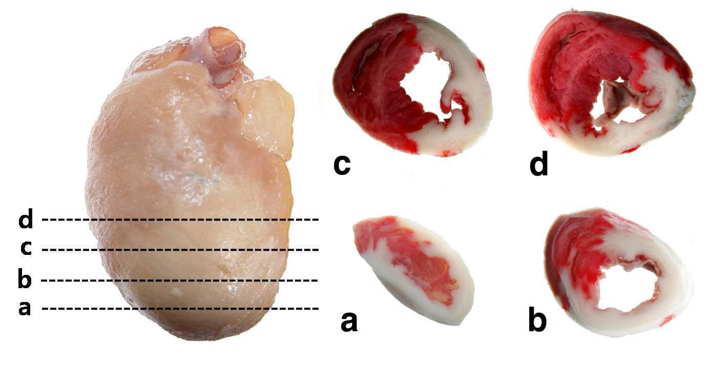 Representative photos at 1 day after ligation of left coronary artery. Heart sections were stained by TTC. White; the nfarction area, Red; the intact area