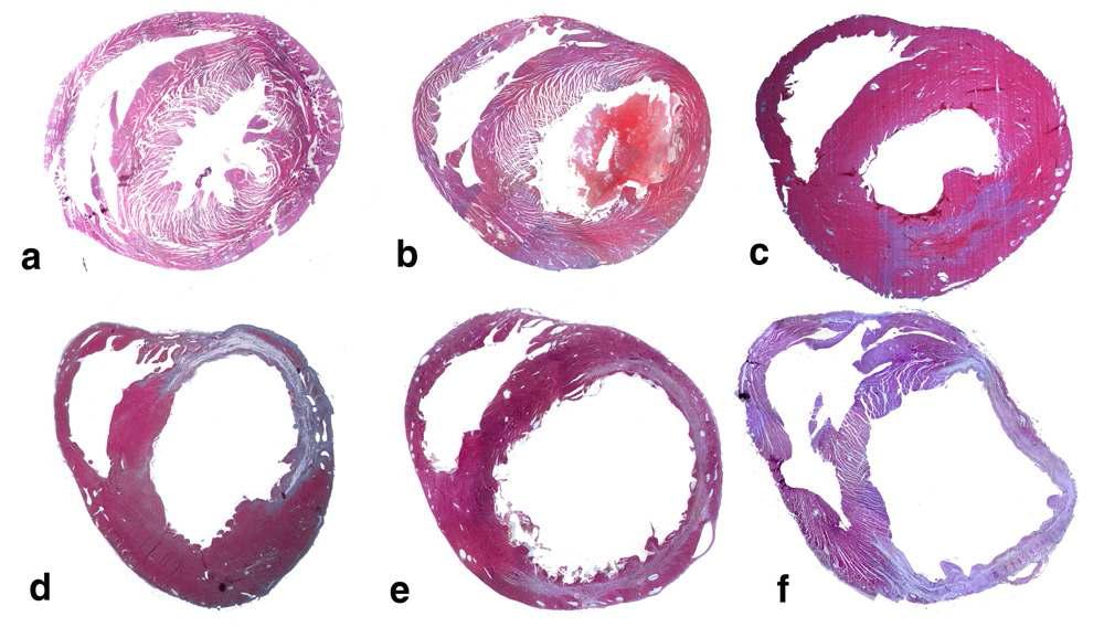 Light micrographs of paraffin embedded sham (a), and MI hearts from 1 days (b), 3 days (c), 7 days (d), 14 days (e) and 30 days (f) after MI operation rats. (H-E stain)