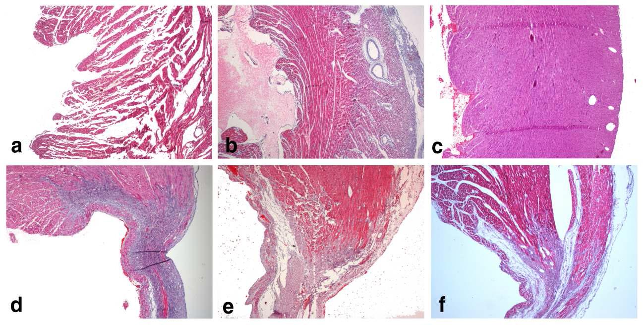 Light micrographs of paraffin embedded sham (a). and MI hearts from 1 days (b), 3 days (c), 7 days (d), 14 days (e), and 30 days (f) after MI operation rats. (H-E stain × 25)