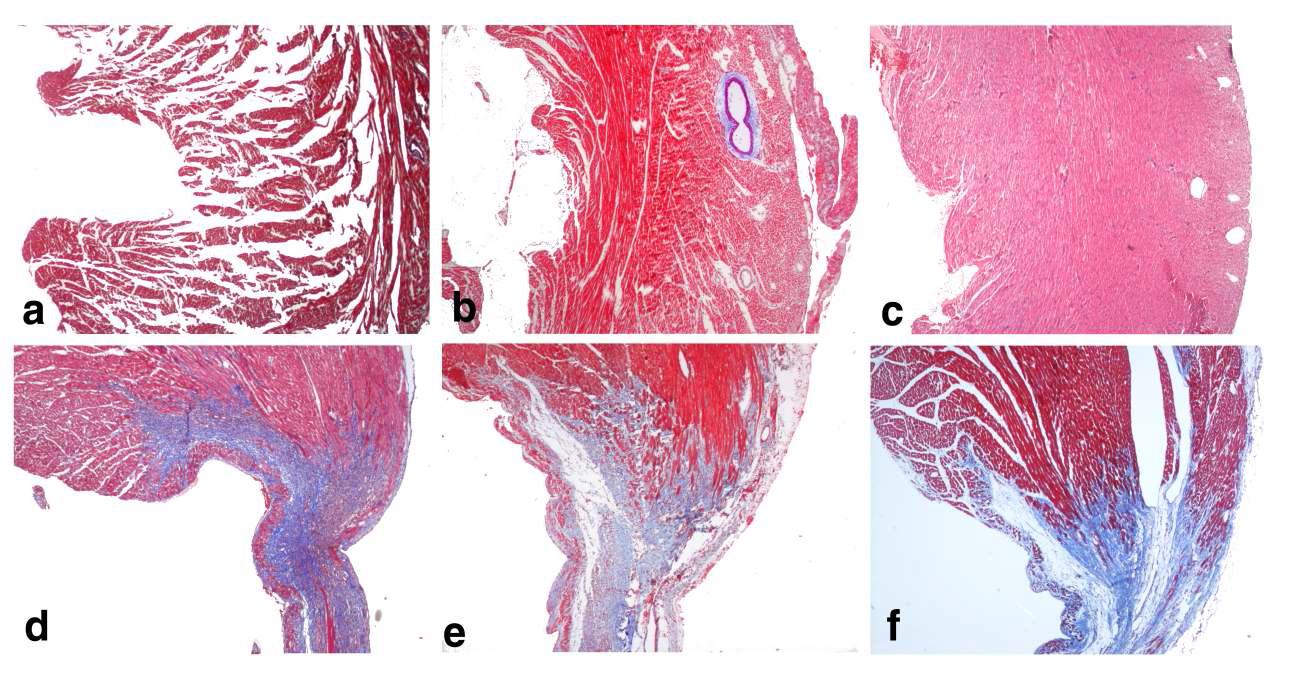 Light micrographs of paraffin embedded sham (a), and MI hearts from 1 days (b), 3 days (c), 7 days (d), 14 days (e), and 30 days (f) after MI operation rats. (Masson’s Trichrome stain × 25)