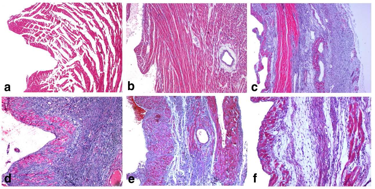 Light micrographs of paraffin embedded sham (a), and MI hearts from 1 days (b), 5 days (c), 7 days (d), 14 days (e) and 30 days (f) after MI operation rats. (H-E stain × 50)