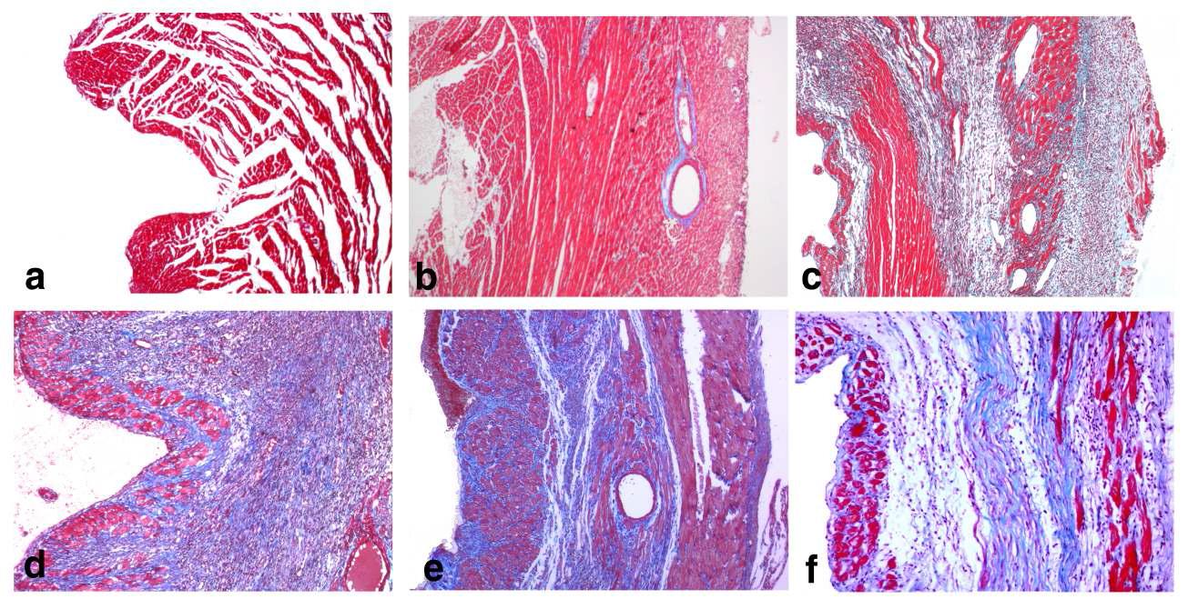 Light micrographs of paraffin embedded sham (a), and MI hearts from 1 days(b), 5 days(c), 7 days(d), 14 days (e), and 30 days (f) after MI operation rats. (Masson’s Trichrome stain × 50)